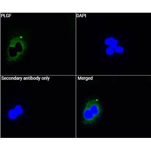 PLGF抗体 (YA1812)