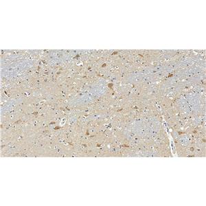 RAP1GAP抗体 (YA1826)