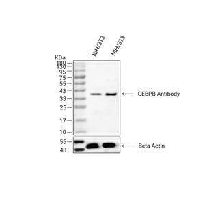 CEBP beta抗体 (YA1835),CEBP beta Antibody (YA1835)