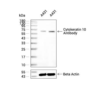 Cytokeratin 10抗体 (YA1857)