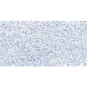 Progesterone Receptor抗体 (YA1866),Progesterone Receptor Antibody (YA1866)