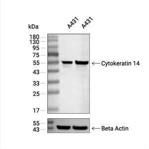Cytokeratin 14抗体 (YA1876),Cytokeratin 14 Antibody (YA1876)