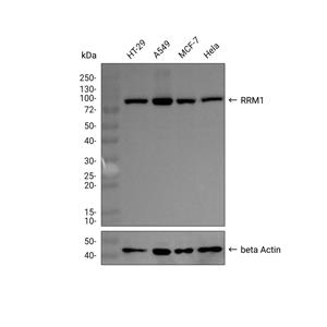 RRM1抗体 (YA1883)