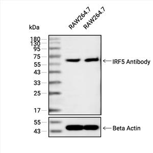 IRF5抗体 (YA1884)
