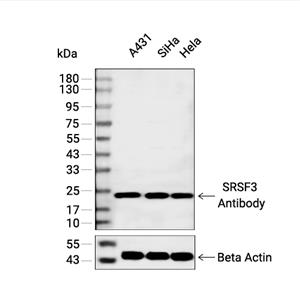 SRSF3抗体 (YA2169)