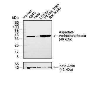 Aspartate Aminotransferase抗体 (YA2175)