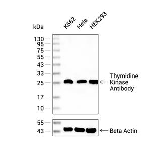Thymidine Kinase抗体 (YA2195)