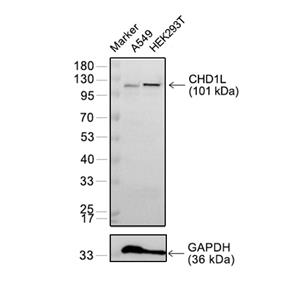 CHD1L抗体 (YA2236)