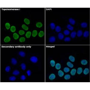 Topoisomerase I抗体 (YA2237),Topoisomerase I Antibody (YA2237)