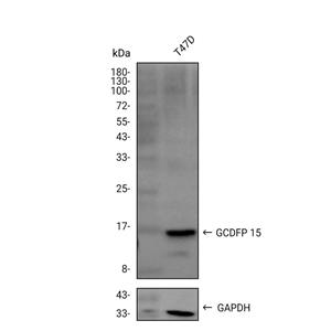 GCDFP-15抗体 (YA2242)