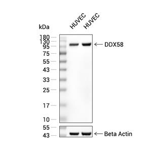 DDX58抗体 (YA2318)