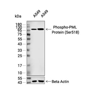 Phospho-PML蛋白 (Ser518)抗体 (YA2632),Phospho-PML Protein (Ser518) Antibody (YA2632)