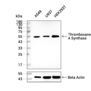 Thromboxane A Synthase抗体 (YA2670)