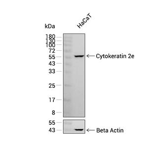 Cytokeratin 2e抗体 (YA2671),Cytokeratin 2e Antibody (YA2671)
