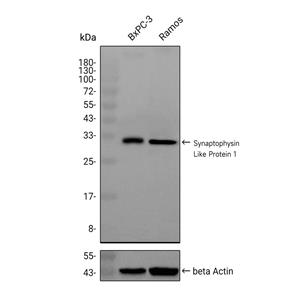 Synaptophysin Like蛋白 1抗体 (YA2124)