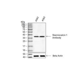 Stanniocalcin 1抗体 (YA2690)