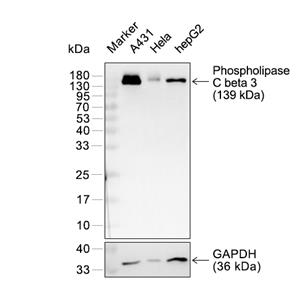 Phospholipase C beta 3抗体 (YA2694),Phospholipase C beta 3 Antibody (YA2694)
