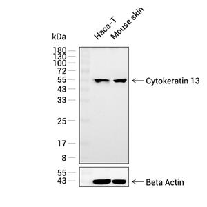 Cytokeratin 13抗体 (YA2695)