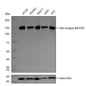 Ephrin Receptor B4抗体 (YA2892),Ephrin Receptor B4 Antibody (YA2892)