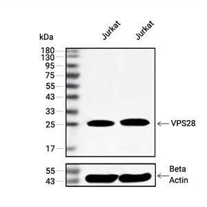 VPS28抗体 (YA2897)