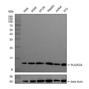 phospholipase A2抗体 (YA2918)