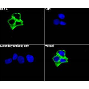 HLA Class 1 A抗体 (YA2940)