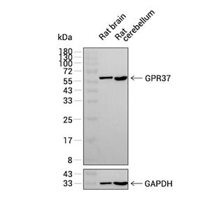 GPR37抗体 (YA2951),GPR37 Antibody (YA2951)