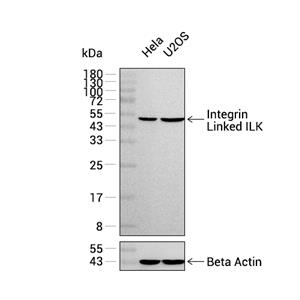 Integrin Linked ILK抗体 (YA3111)