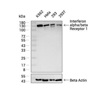 Interferon alpha/beta Receptor 1抗体 (YA3112)