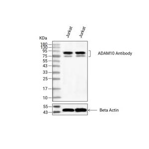 ADAM10抗体 (YA3292),ADAM10 Antibody (YA3292)