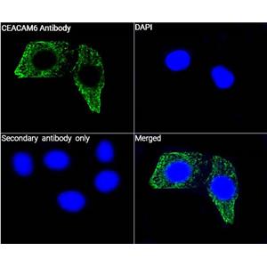 CEACAM6抗体 (YA3351),CEACAM6 Antibody (YA3351)