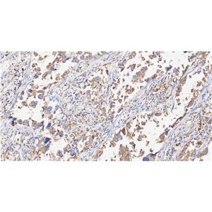 CHRNA7抗体 (YA3499)