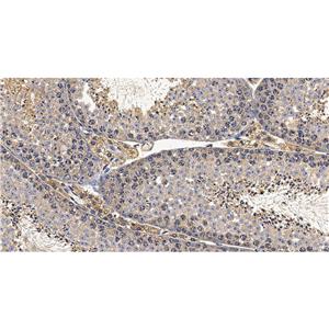 ALKBH5抗体 (YA3429)