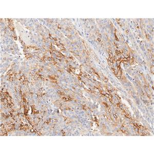 Claudin 18.1抗体 (YA5683)