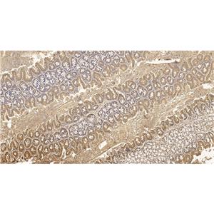 MMP2抗体 (YA5459),MMP2 Antibody (YA5459)