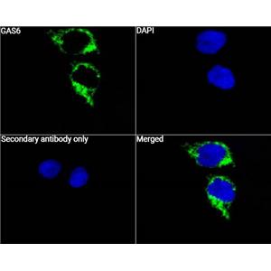 Gas6抗体 (YA5573)