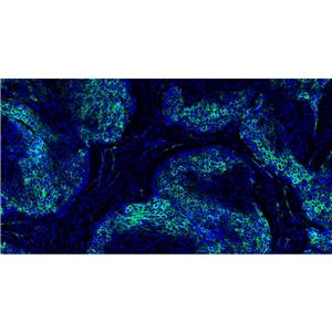 Tyrosinase抗体 (YA5745)