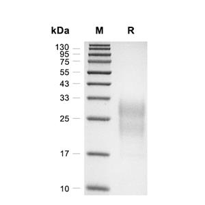 GM-CSF蛋白, Human (CHO)