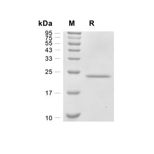 IL-6蛋白, Mouse,IL-6 Protein, Mouse