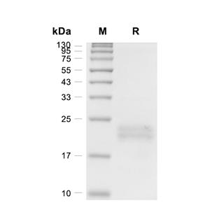 IL-1 beta蛋白, Human (CHO)