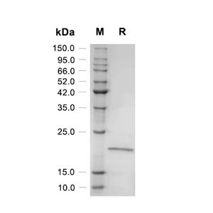 CCN2/CTGF蛋白, Human (HEK293)