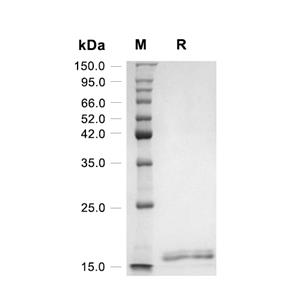 KGF-2/FGF-10蛋白, Mouse,KGF-2/FGF-10 Protein, Mouse