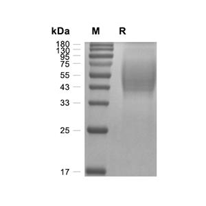 CA125蛋白, Human (HEK293, His)