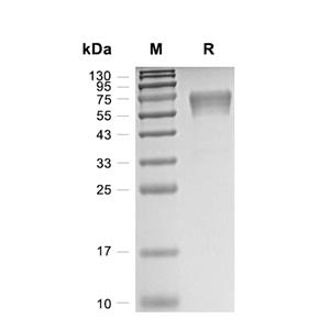 PD-1蛋白, Human (CHO, Fc)