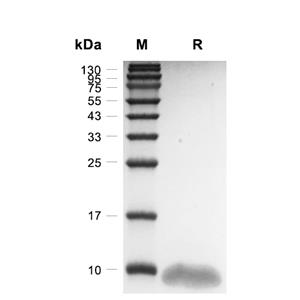Fractalkine/CX3CL1蛋白, Human