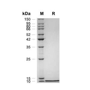I-TAC/CXCL11蛋白, Human