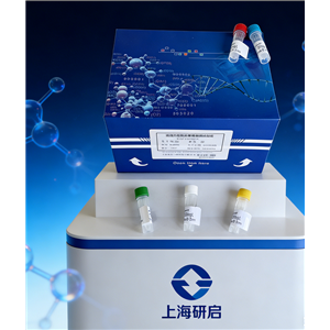 谷草转氨酶/天冬氨酸氨基转氨酶(GOT/AST)试剂盒