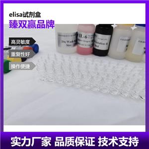 人Smad同源物7(Smad7)ELISA试剂盒,Human Smad7 ELISA KIT