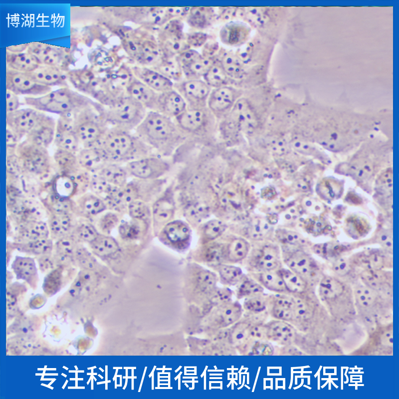 SK-BR-3-EGFP-LUC;人乳腺癌细胞绿色荧光蛋白-荧光素酶标记,SK-BR-3-EGFP-LUC