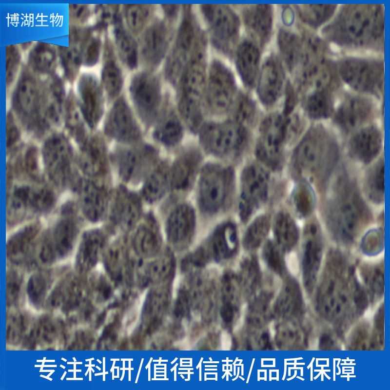 人Burkitt’s淋巴瘤细胞；RAJI 'A',Raji Cells (Human Burkitt's Lymphoma)